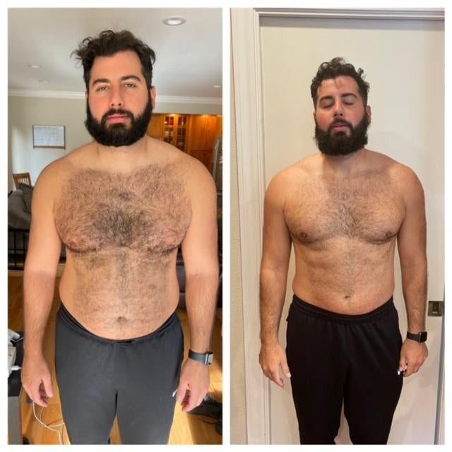 Federico C. — antes y después